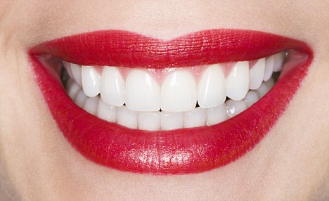 Balti dantys po ortodontinio gydymo