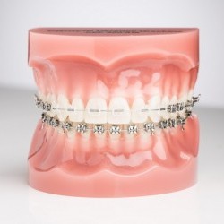 Kas lėtina ortodontinį gydymą?